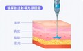 从分子量配比到分子形态:廖万清院士视野下的玻尿酸五代技术演进