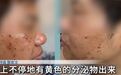 “半小时内不交1万元就会毁容!”