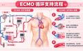 迈柯唯、汉诺、费森尤斯、赛腾:谁在主导中国ECMO市场?