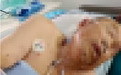 夫妻天桥散步突然遭马蜂群围攻,双双被送进ICU