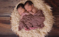 双胞胎越来越多，可能是因为女性生育越来越晚了