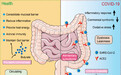 兰大研究表明:健康的肠道菌群可预防新冠病毒入侵肠道