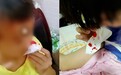 河南上百名孩子流鼻血?官方通报