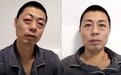 3岁女孩高烧、眼睛肿成桃 以为感染"哭株" 接下来的发展让人后怕