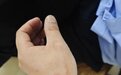 龙南一市民挑衅警方执法还咬伤辅警 被拘留十日