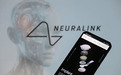 马斯克脑机公司Neuralink申请“心灵感应”商标,暂时被驳回