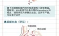 处理流鼻血 你真的做对了吗