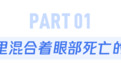 眼屎突然变多 可能是你的眼睛生病了