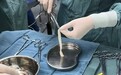 济南南郊医院全周期守护女性健康,3D生物束带紧缩术破解盆底损伤难题