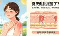 夏天皮肤报警了?出汗加暴晒 这些误区快避开