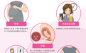 守护女性盆底健康,科学修复重塑从容魅力