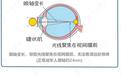 珠海爱尔眼科林雅娜主任:戴近防镜并不会“一劳永逸”,科学控制很重要