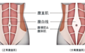 产后为什么小腹还是突出?杏林腹壁成形术