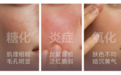 年轻人的脸,正在被「糖、氧、炎」反复拉扯? 晓姿AG焕颜抗糖丸从三条路径回应当代年轻肌肤状态
