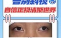 佛山爱尔杨倩琪医生开学季提醒:12岁女孩斜视手术实录,别让“长大就好”耽误孩子