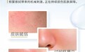 入秋敏肌用纸新解法 可心柔推出敏肌适用Lotion保湿纸