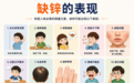 儿童缺锌十大表现及科学补锌选品指南(2026新版)