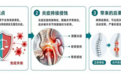 病情反复、药效递减?专利免疫吸附技术破解强直治疗核心难题