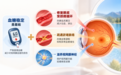 守护眼底健康,控糖之外还要做什么?