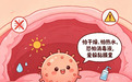 读懂淋球菌的传播套路 学会保护自己