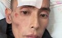 肝癌去世网红曾劝诫大家少喝酒少熬夜 39岁网红确诊肝癌仅9个月离世