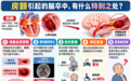 世界卒中日|心乱跳竟是脑卒中诱因!掌握房颤的科学管理方法