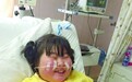 11岁胖妞1个月疯长20斤 身高1.34米体重126斤/图