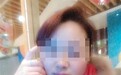 浙江一女子遭家暴被丈夫割鼻子:他说鼻子最好看(图)