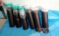 老人体内长40公分肿瘤 手术抽出12000毫升积液(图)