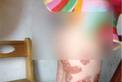 温州4岁女童遭父亲虐待 双腿多处被灼烫流脓