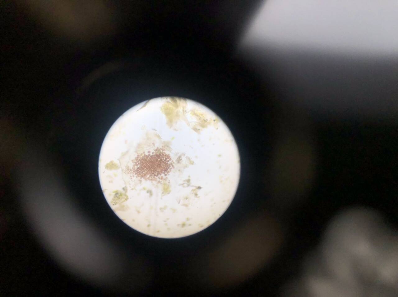 显微镜下的紫菜孢子,圆形红色为成活孢子