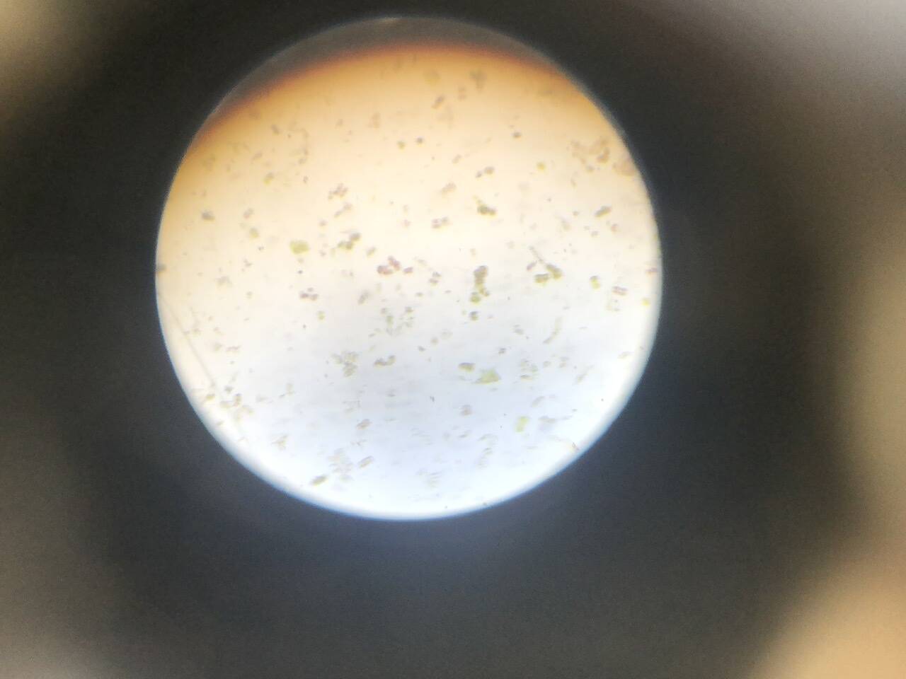 显微镜下的紫菜孢子,圆形红色为成活孢子,其他颜色的不是紫菜孢子