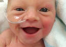 3斤重的早产宝宝用最开心的笑脸宣告：我活下来啦