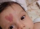 宝宝天生额头上有个爱心胎记 自带丘比特光环