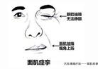 动动手指就能治疗面瘫,面瘫的指压疗法