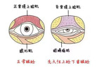 带你简单认识眼睛的结构