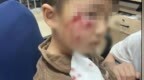 3岁男童被恶犬咬伤18天后不幸离世，母亲发声