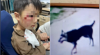 “狂犬病疫苗无法保证不感染”，3岁男童被狗咬伤离世，调查结果公布