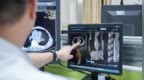拆了 20 年「血管炸弹」这名医生决定用 AI 脱困