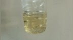 8岁男孩突然尿“酱油”，血液科专家一眼识破 “吃红细胞” 的怪病