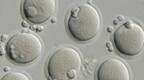 日本利用干细胞“心肌球”治疗心衰