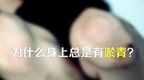 为什么身上总是有淤青？