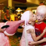 恐怖！揭秘当今全球最令人恐惧的十大怪病...