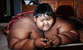 世界最胖男孩380斤 缩胃手术有望减掉200斤
