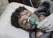 直击｜叙利亚毒气遭袭击11名儿童丧生 安理会或介入