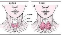 58898abfc161347_size17_w424_h232.jpg