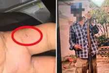 男子抓蛇被咬后淡定合影