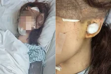 女孩被闺蜜刺伤