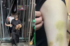 男子劝阻他人带狗进店被打