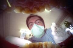 52岁男子口腔相机作品